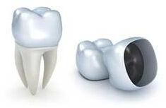 Dental Crowns