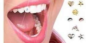 Tooth Jewellery