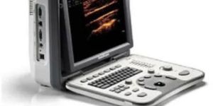 3D Ultrasound Machine