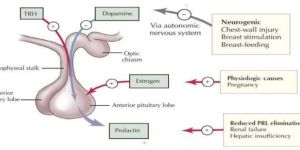 Hyperprolactinemia Treatment