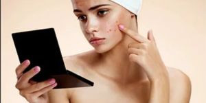 Skin Problem Treatments