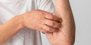 Syphilis Treatment Service