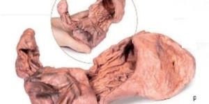 Stomach 3D Anatomical Model