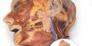 Superficial Facial Nerves with Parotid Gland 3D Anatomical Model