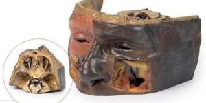 Superior Orbit 3D Anatomical Model