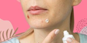 Turmeric Anti Acne Cream