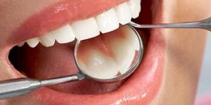 Periodontal Therapy