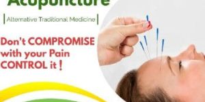 Acupuncture Treatment