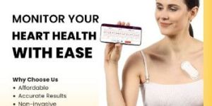 Holter Monitor Test Service