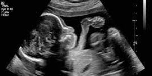 Obstetric Ultrasound Services