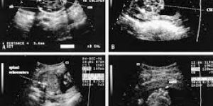 Obstetrics Sonography Service