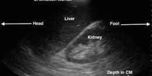 General Abdominal Ultrasound Service