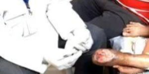 Wound Care Dressing Service