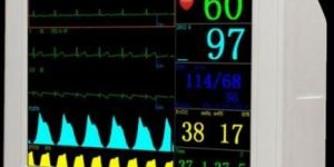 Veterinary Patient Monitor