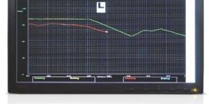 Driver Advisory System