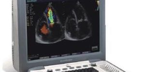 Sonoscape S8 Colour Doppler Ultrasound