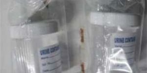 60 ML Urine Container