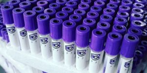 K3 EDTA Safety Cap Blood Collection Tube