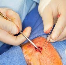 Skin Surgical Treatment