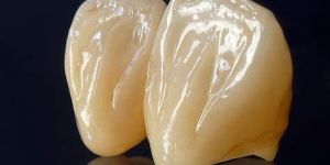 Highest Quality Computerized Crowns