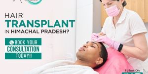 Hair Transplant Service