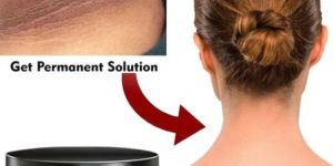 Neck Whitening Cream