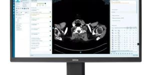 Eonis Color 8MP (MDRC-8132) clinical display