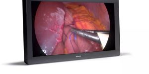 MDFC8232 3xB Surgical Displays