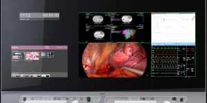 MDMX22449 GNTB Surgical Displays