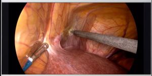 MDSC8231 12G Surgical Displays