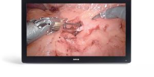 MDSC-8232 M3D Surgical Displays