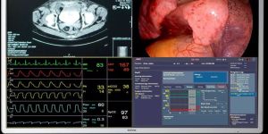 MDSC8255 Surgical Displays