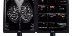 Nio Color 5MP (MDNC-6121) Mammography Display