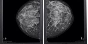 Nio Gray 5.8MP (MDNG-6221) Diagnostic Monitors