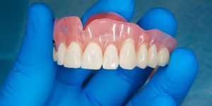 Complete Dentures
