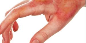 Plastic Surgery Treatment