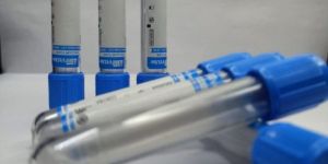 3.2 % Sodium Citrate Non Vacuum Tube