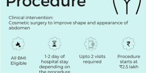 Tummy Tuck Procedure