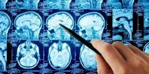 Neurosurgery Treatment Services