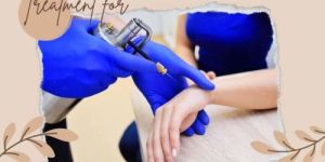 Mole Removal Service