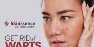 Skin Wart Removal Service