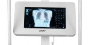integrated digital mobile x-ray machine