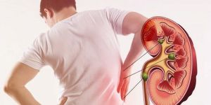 Kidney Stone Removal Treatment Service