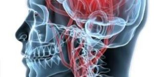 Neurology Treatment Service