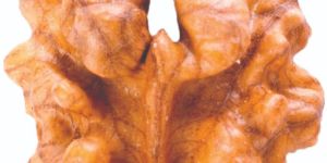 Psychiatric Hospitals