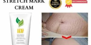 Stretch Marks Cream