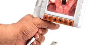 Straight Blade With Curved Tip Flexible Video Laryngoscope