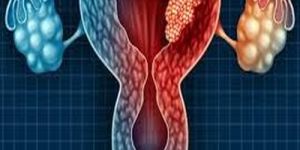 Cervical Cancer Treatment Service