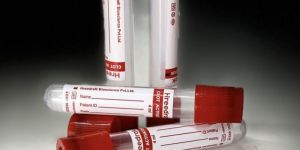 Clot Activator Non Vacuum Blood Collection Tube