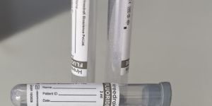 Fluoride Single Cap Blood Collection Tube